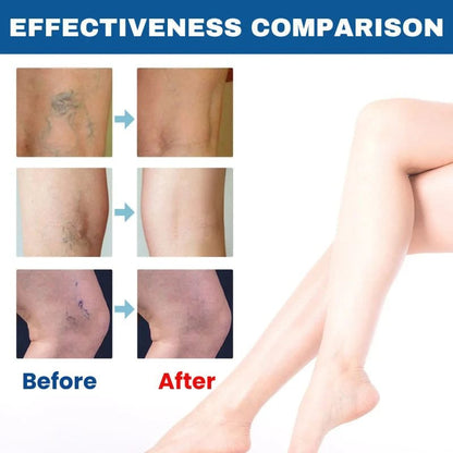BioEquis Vein Relief Spray